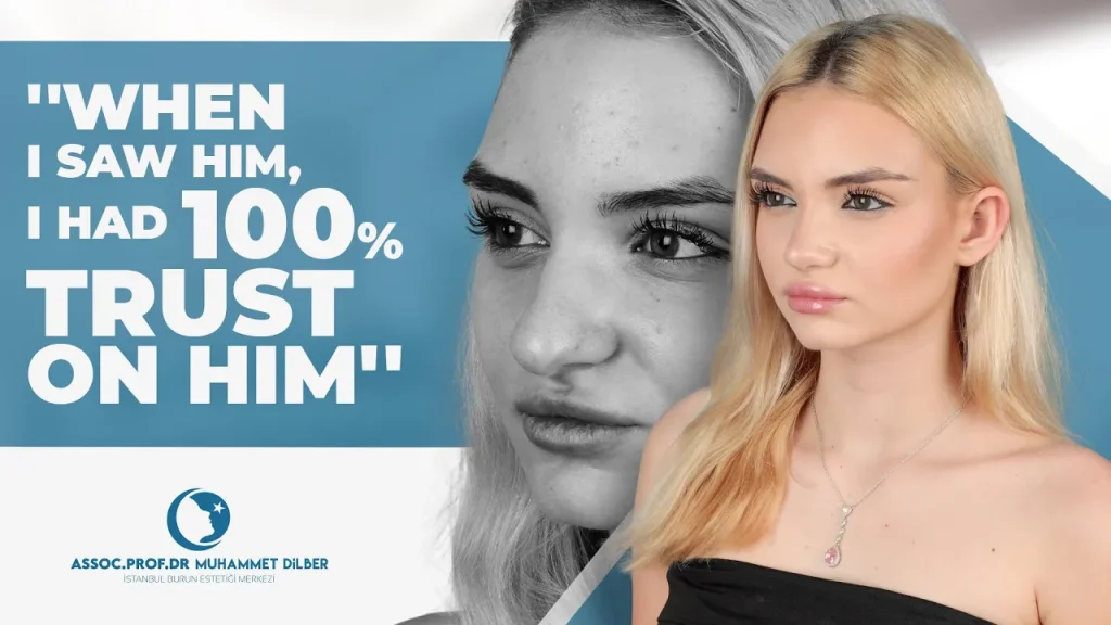 rhinoplasty in turkey - nose job before after