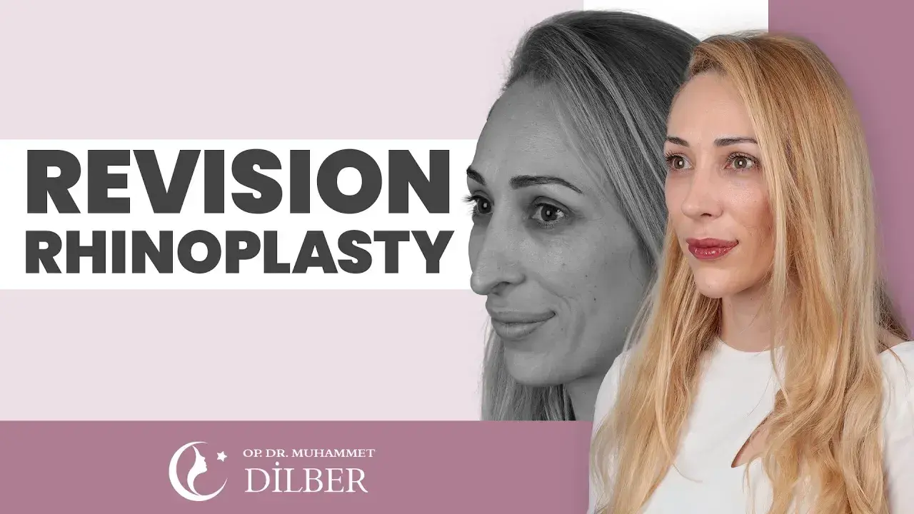 best revision rhinoplasty in turkey - secondary rhinoplasty in turkey