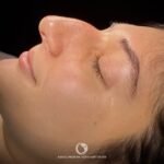 what is big humpy nose?